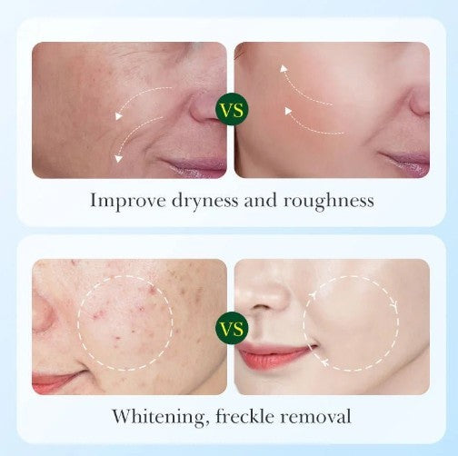 Sadoer - Licorice Root Whitening Skin Care Set