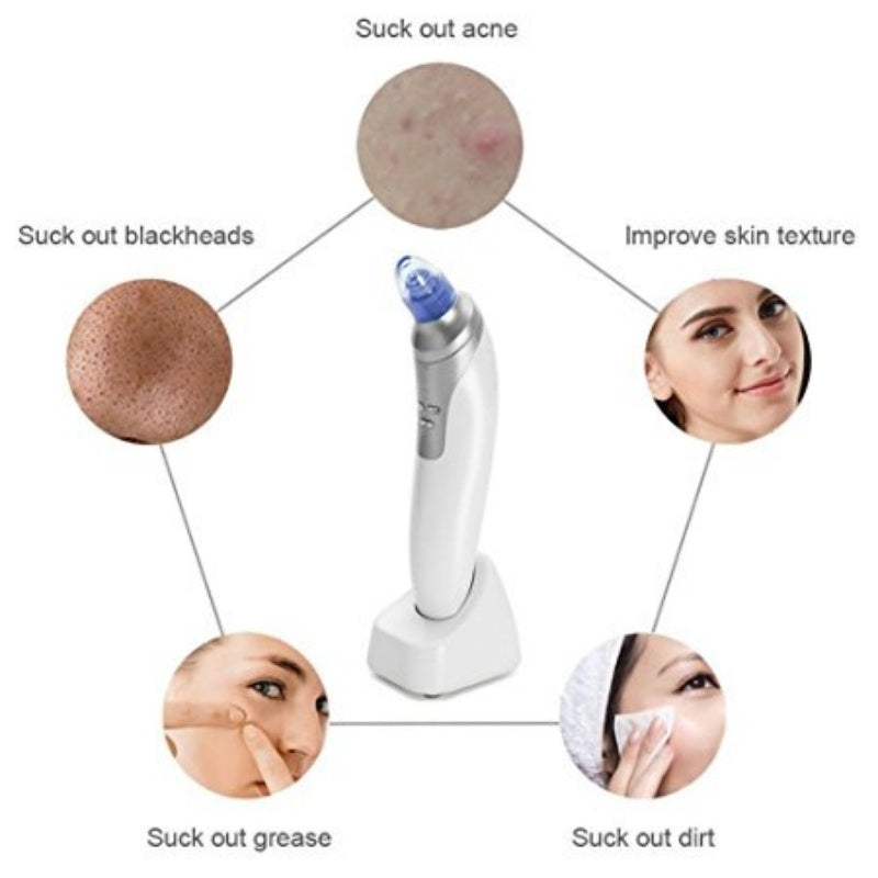 Blackhead Remover